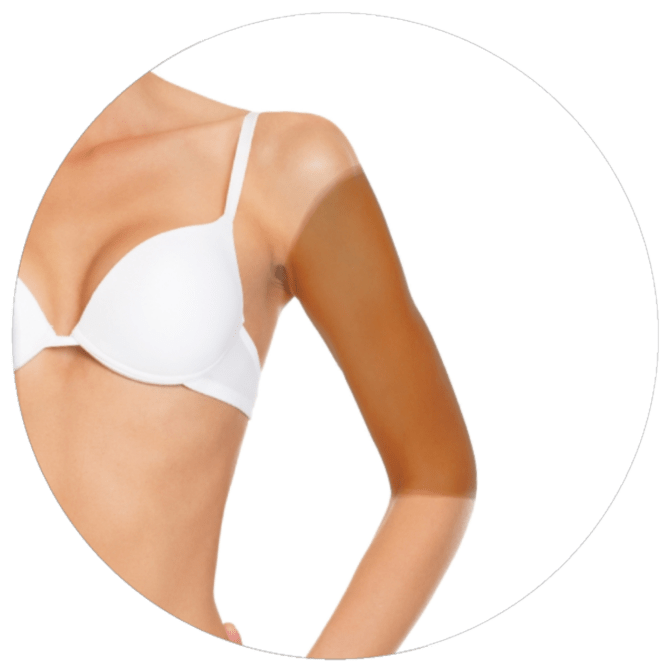 Brazo superior