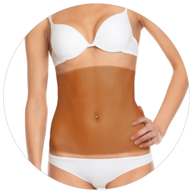 Abdomen