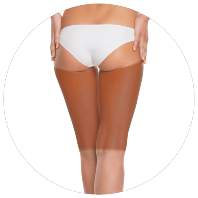 Muslo posterior
