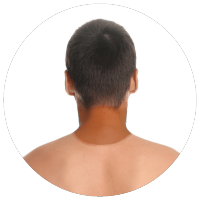 Cuello posterior