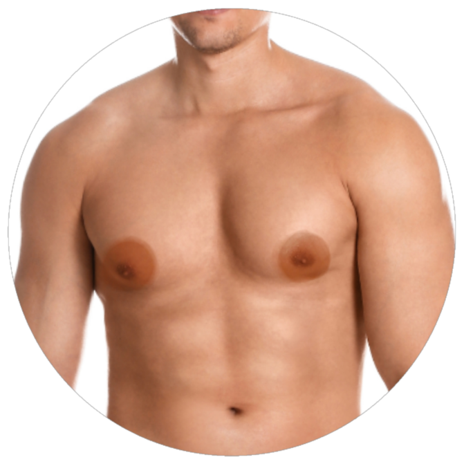 Areolas